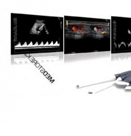 система ультразвуковой визуализации портативная Ростов-на-Дону