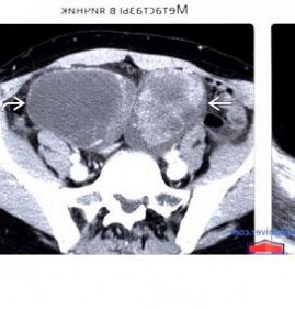 Визуализация яичника Челябинск