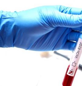 Емкость для крови - модель 4