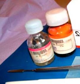 фосфатный цемент - тип 3