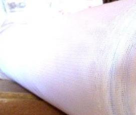 Москитная сетка белая - модель 3