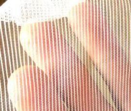 Москитная сетка с репейной лентой - модель 2