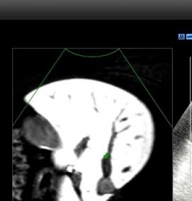 Мультимодальная визуализация - тип 3