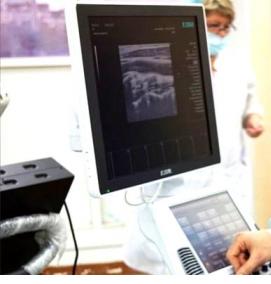 система ультразвуковой визуализации портативная - тип 4