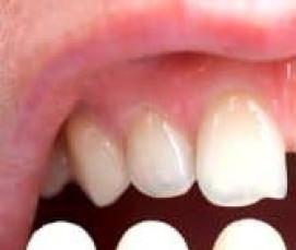 тонированный шпон - модель 1