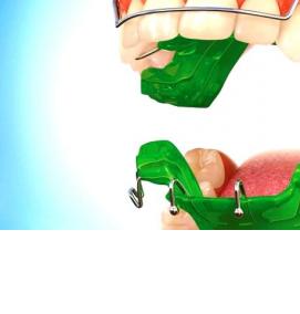 твинблок рефтинский - модель 1