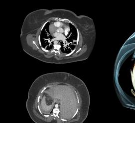 Визуализация тела - вариант 2