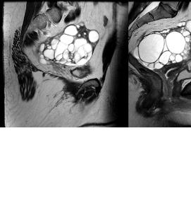Визуализация яичника - модель 1