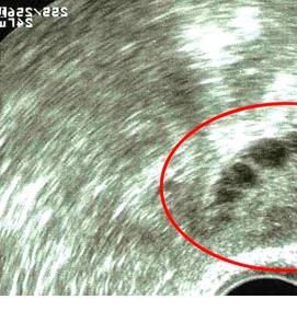 Визуализация яичника - модель 3